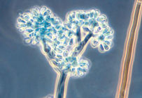 Spores de Botrytis cinerea sur une grappe de raisin...